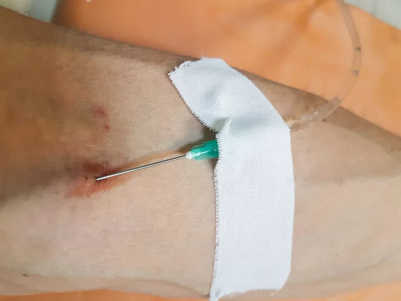 Игла медицинской капельницы в вене